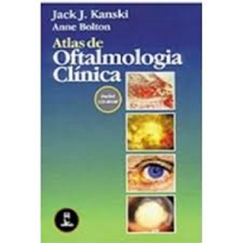 Atlas de Oftalmologia Clínica