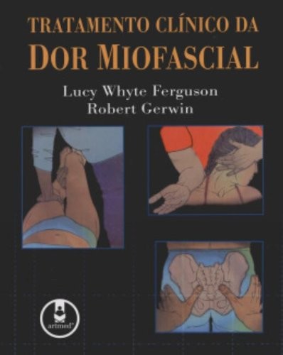 Tratamento Clínico da Dor Miofascial