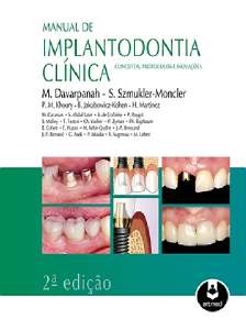 Manual de Implantodontia Clínica - Conceitos, Protocolos e Inovações