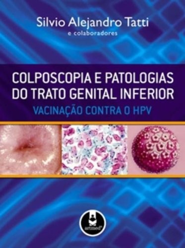 Colposcopia e Patologias do Trato Genital Inferior - Vacinação Contra o HPV