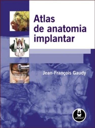Atlas de Anatomia Implantar