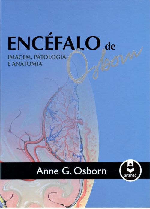 Encéfalo de Osborn - Imagem, Patologia e Anatomia