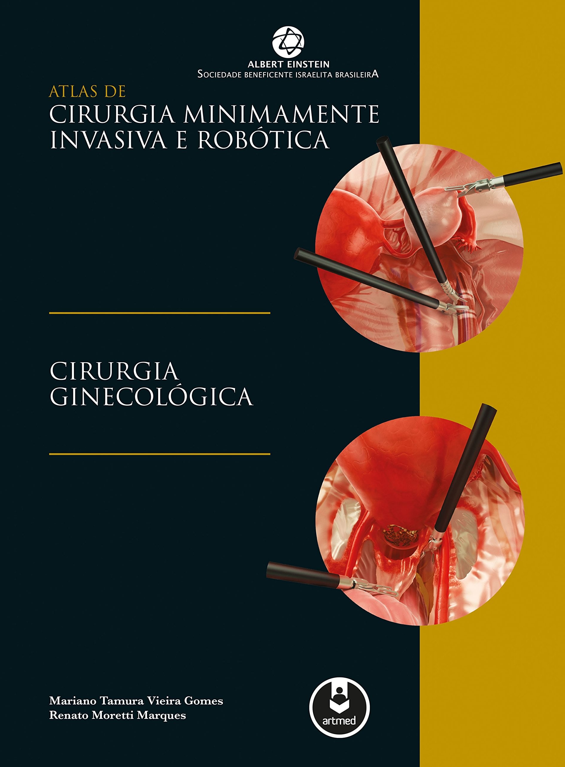 Atlas de Cirurgia Minimamente Invasiva e Robótica: Cirurgia Ginecológica